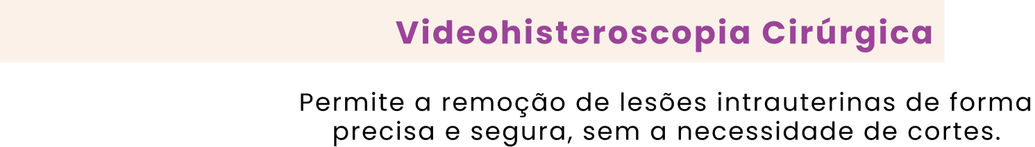 Videohisteroscopia Cirúrgica Permite a remoção de lesões intrauterinas de forma precisa e segura, sem a necessidade de cortes.